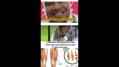 TIPOS DE LESÃO POSTERIOR COXA
